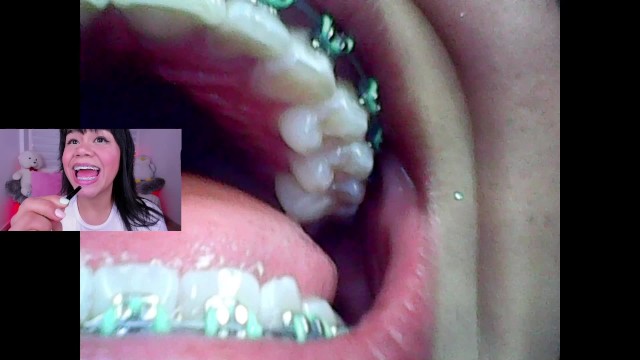 Lila jordan迷你摄像头vore fetish内窥镜