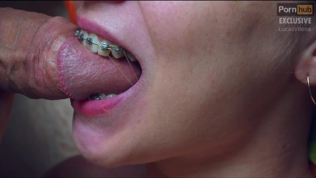 戴着牙套的性感少年做口交，嘴里含着口香糖