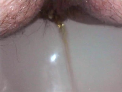 Pipi与医用内窥镜和小灌肠非常接近，都在屁股里——超级恋物视频