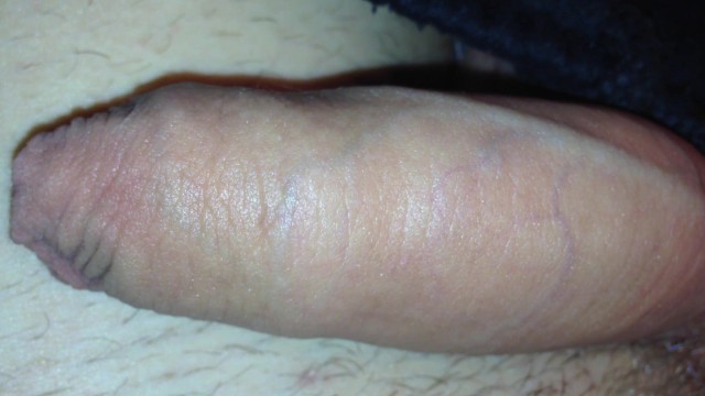 看着我软弱的迪克-HD